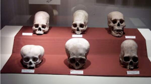 Ancient Alien Elongated Skulls Not Human, According To Scientists 6