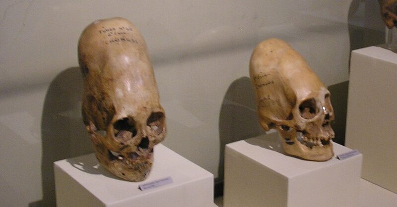 Ancient Alien Elongated Skulls Not Human, According To Scientists 5
