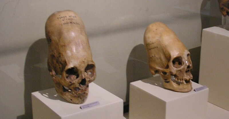 Ancient Aliens: Paracas skull DNA Test shows why story of humankind has to be rewritten 1
